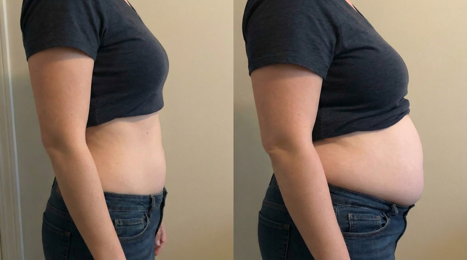 Before and after results with CitrusBurn™